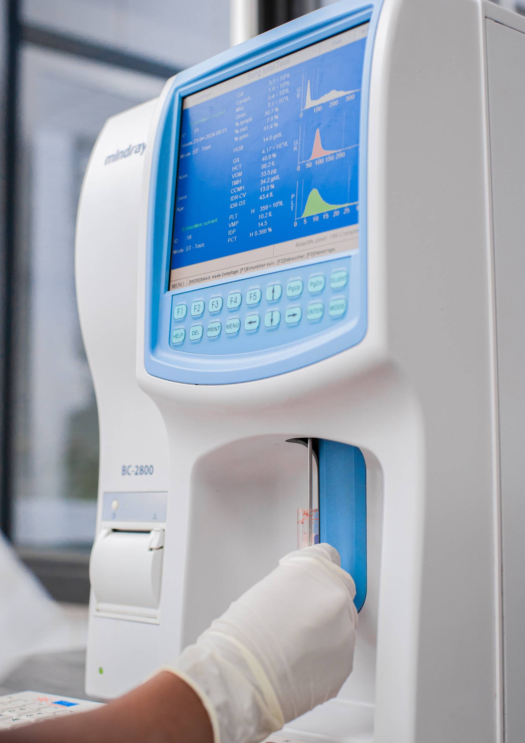 Le BC-2800Ve : Équipement de laboratoire Analyseur d′hématologie entièrement automatique